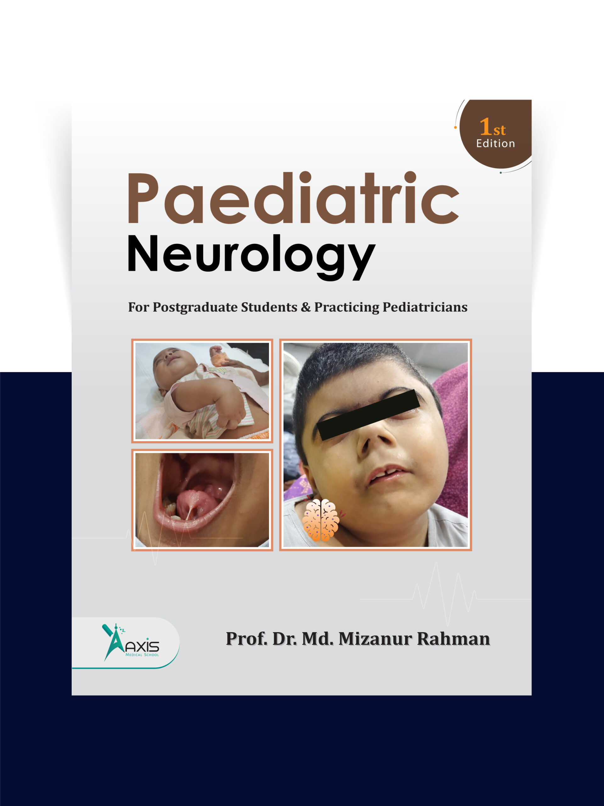 Paediatric Neurology